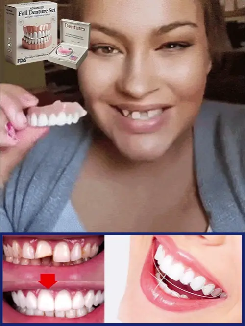 š¦·Full Denture Set - Image 3